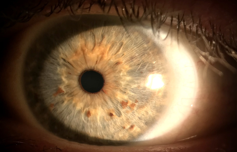 Oftalmologo de torrevieja. Visionker es la primera clínica multidisciplinar que hay en Torrevieja para tratar las enfermedades oculares (de sus ojos). Disponemos de los mejores oftalmólogos de Alicante y Torrevieja. Eye Clinic Torrevieja - Eye Doctor Torrevieja (Alicante)