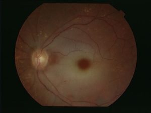 VISIONKER oftalmólogos de la VEGA BAJA, actuación en toda la comarca y poblaciones vecinas: Torrevieja. Orihuela. Pilar de la Horadada. Almoradí. Callosa de Segura. Rojales. Guardamar del Segura. Albatera. Catral. Redován. San Fulgencio. Dolores. Cox. Bigastro. San Miguel de Salinas. Benejúzar. Los Montesinos. Rafal. Formentera del Segura. Benijófar. Algorfa. Granja de Rocamora. Jacarilla. San Isidro. Benferri. Daya Nueva. Daya Vieja. Crevillent. Santa Pola. Elche. San Pedro del Pinatar. San Javier. Cartagena. Murcia. Alicante.